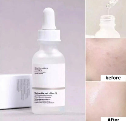 The Ordinary Niacinamide 10% + Zinc 1%